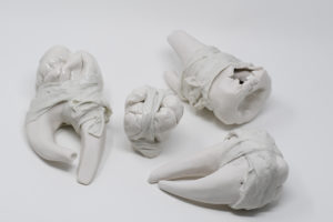 In the early 1900's American psychiatrist Henry Andrews  Cotton pulled over 10,000 rotted teeth from unwilling patients at the New Jersey State Hospital. He believed bad teeth was the leading cause of mental illness.